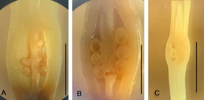 https://www.journalssystem.com/agb/f/fulltexts/159854/Figure_3_min.jpg