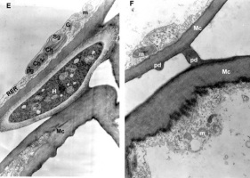 https://www.journalssystem.com/agb/f/fulltexts/172969/Figure_2EF_min.jpg