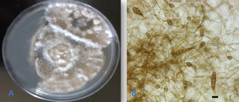 https://www.journalssystem.com/agb/f/fulltexts/190222/Figure_3_min.jpg