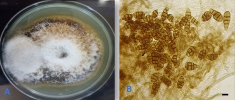 https://www.journalssystem.com/agb/f/fulltexts/190222/Figure_4_min.jpg