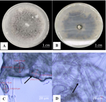 Macroscopic and microscopic characteristics of C. gloeosporioides after 7 days of incubation: (A) Upper view of the colony; (B) Lower view of the colony; (C) Conidia; (D) Septate hyphae.