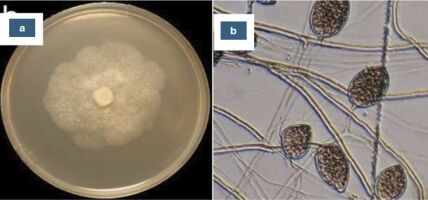 Phytophthora capsici pathogen isolated from chili plants: (a) macroscopic characteristic; (b) microscopic characteristic.