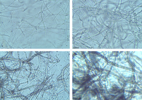 The figure 7 contains four photos of deformed and degenerated hyphae of fungi P. diachenii K651 (A) and C. dematium K425 (B) after 8 day of their growth on the PDA medium with an addition of Viflo® Cal S ×500 and their control colonies.