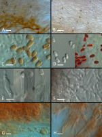 https://www.journalssystem.com/amy/f/fulltexts/159752/Figure_3_min.jpg