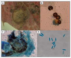 https://www.journalssystem.com/amy/f/fulltexts/159768/Figure_1_min.jpg