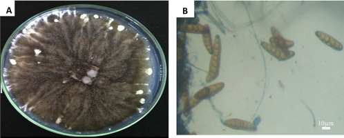 https://www.journalssystem.com/amy/f/fulltexts/159779/Figure_1_min.jpg