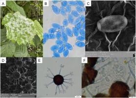 https://www.journalssystem.com/amy/f/fulltexts/177131/Figure_1_min.jpg