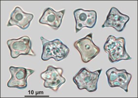 Microscopic view of Entoloma conferendum basidiospores (specimen HM-2011-0022). Photo: M. Halama.