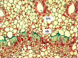 https://www.journalssystem.com/asbp/f/fulltexts/159510/ad301ac9-77d1-482a-aeb6-549c70d62a13-ufigure-1_min.jpg