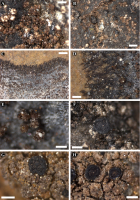Morphology of Rehmia furfurosa. Panel A: thallus of the holotype (scale bar 0.02 mm). B: thallus and apothecium on a damaged part of the holotype (0.05 mm). C and D: rarely encountered prothallus (O-L 163730) (0.1 and 0.02 mm). E: granular thallus (O-L 163730) (0.01 mm). F-H: apothecia with umbonate discs, respectively GLM-L-0021351, O-L182027, Poumarat SP 2016-85 (0.02 mm).