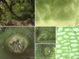 Multi-panel figure presenting the morphology and anatomy of Pellia epiphylla: (A) general view of the green thallus growing among mosses, (B) microscopic view of slime hairs, (C&ndash;D) close-up views of archegonia on the thallus surface, (E) an antheridium embedded in the thallus, and (F) microscopic view of polygonal thallus cells with visible cell walls and chloroplasts.