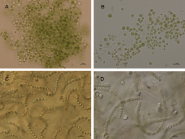 Wybrane gatunki glonów oraz cyjanobakterii: A i B – Chlorella vulgaris (zielenice), C i D – Nostoc sphaericum (cyjanobakterie), fot. J. Piątek.